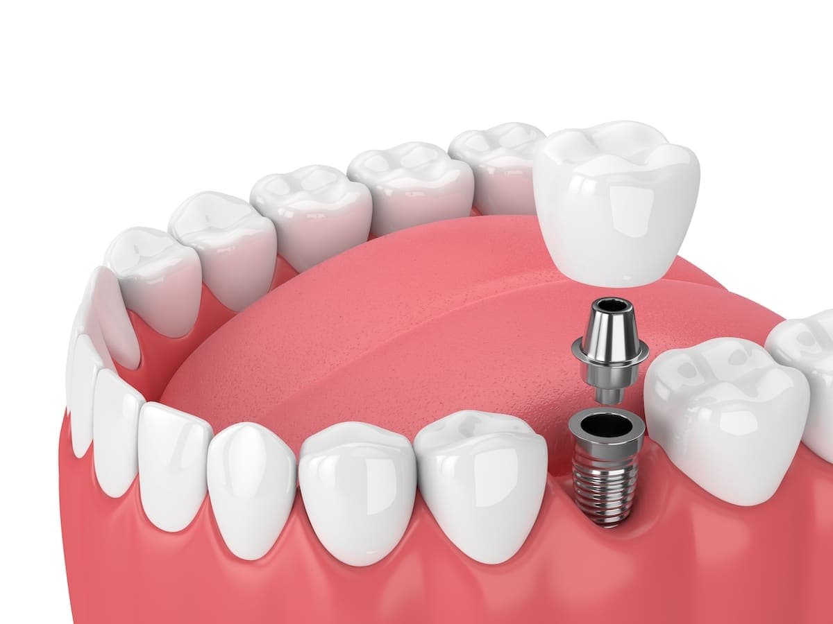 Dentist examining a patient for signs of gum disease